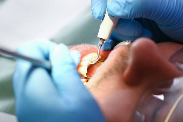 Best Walk-In Emergency Dentist in Terrace Park, OH